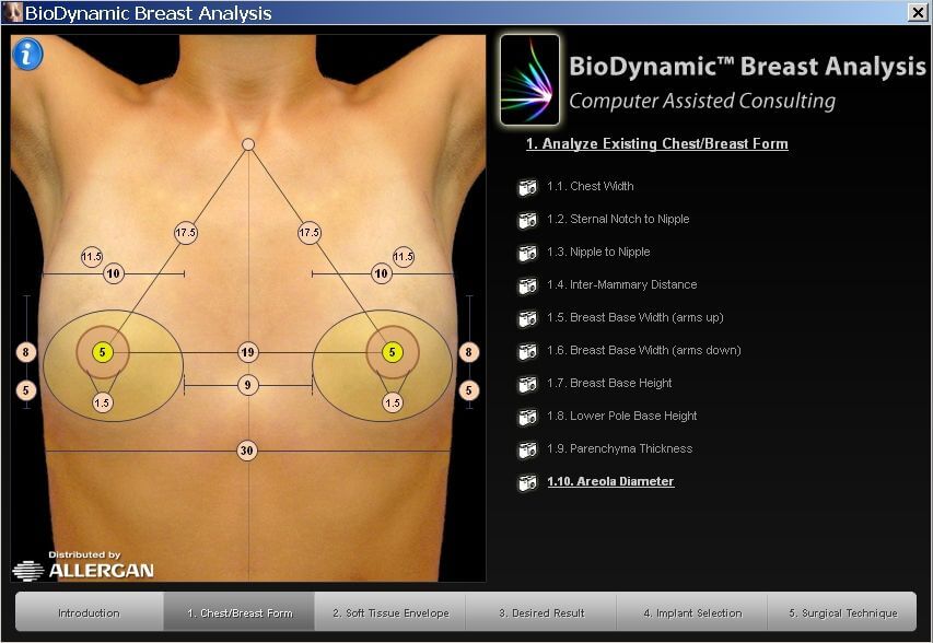 Biodynamic System komputerowego doboru implantów piersiowych